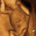14 hetes magzat ultrahang képe - CsodaBent 4d ultrahang
