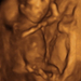 15 hetes magzat ultrahang képe - CsodaBent 4d ultrahang