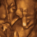 17 hetes magzat ultrahang képe - CsodaBent 4d ultrahang