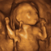 18 hetes magzat ultrahang képe - CsodaBent 4d ultrahang
