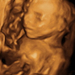 20 hetes magzat ultrahang képe - CsodaBent 4d ultrahang