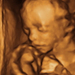 22 hetes magzat ultrahang képe - CsodaBent 4d ultrahang
