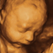 25 hetes magzat ultrahang képe - CsodaBent 4d ultrahang