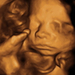 26 hetes magzat ultrahang képe - CsodaBent 4d ultrahang