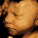 31 hetes magzat ultrahang képe - CsodaBent 4d ultrahang