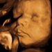 32 hetes magzat ultrahang képe - CsodaBent 4d ultrahang