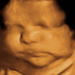 36 hetes magzat ultrahang képe - CsodaBent 4d ultrahang