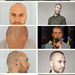 Hair transplant&nbsp;photos&nbsp; in general <a href="http://pha