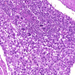 chorionepithelioma 2-féle sejt