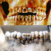 ancient-dentistry-golden-bridges