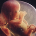 foetus -magzatpóz