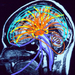 thalamus az agy központi állomása