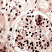 sarcocystis cruzi (Bo vese glomerulus)